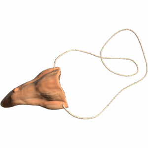 CrookedNose